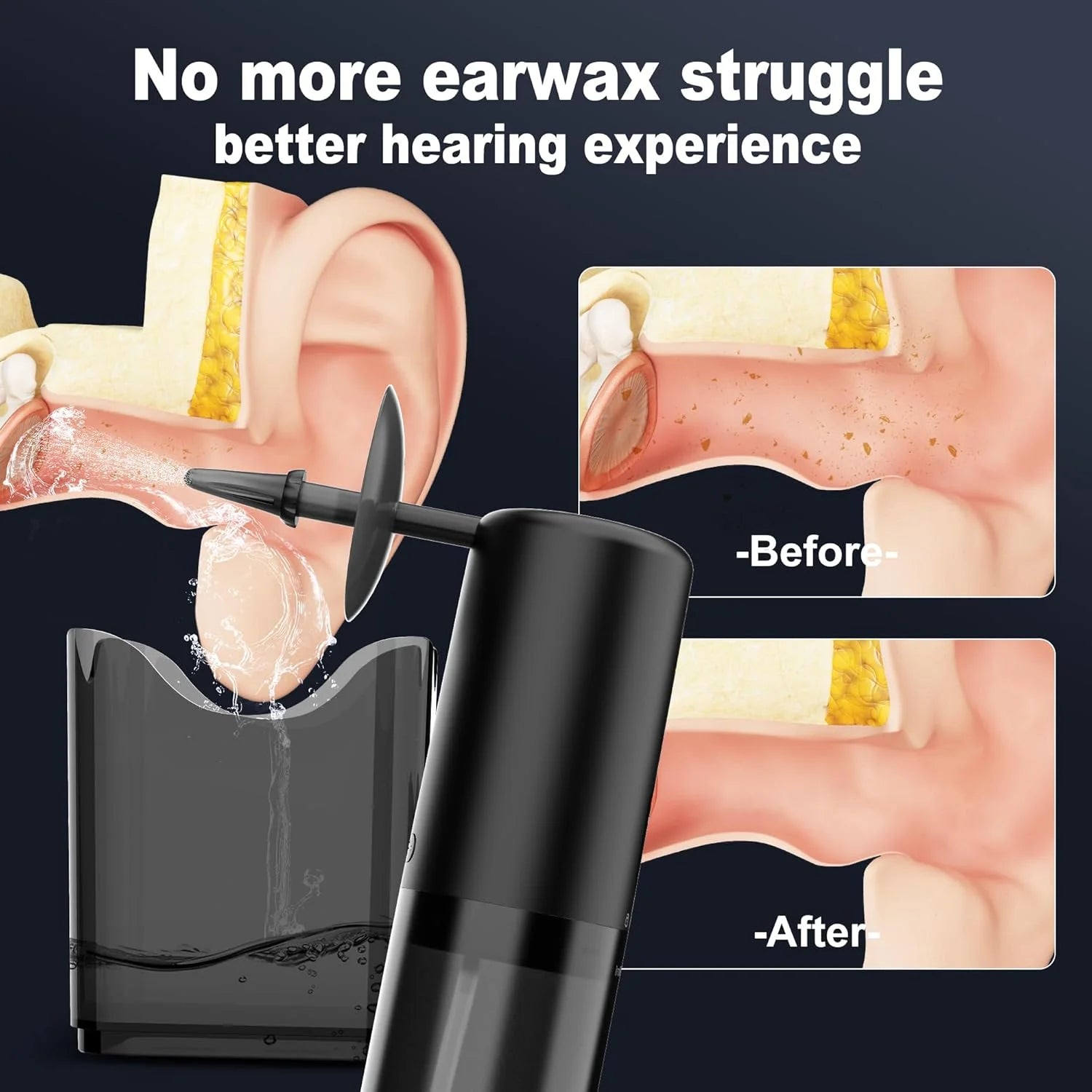 Water Powered Ear Cleaner, Safe & Effective Electric Triple Jet Stream with 4 Pressure Settings for Ear Wax Buildup, Water Resistant, USB Rechargeable Black
