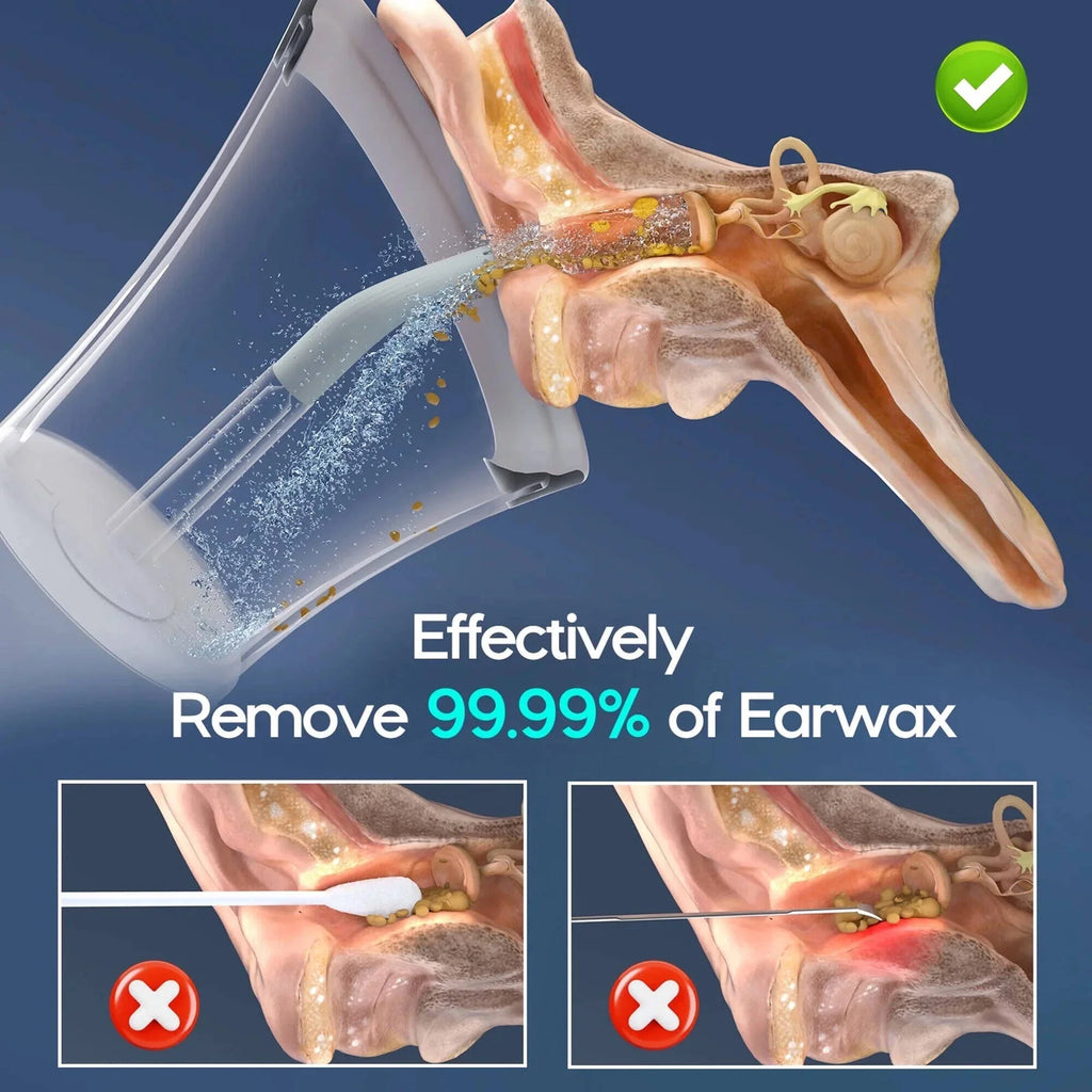 Ear Wax Removal with One-Piece Waste Tank, Ear Cleaner with Water Temperature Sensor, 4 Pressure Settings, Ear Cleaning Kit for Ear Wax Buildup & USB-C Cable, IPX6, Gray