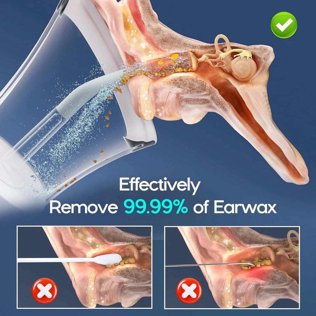 Ear Wax Removal with One-Piece Waste Tank, Ear Cleaner with Water Temperature Sensor, 4 Pressure Settings, Ear Cleaning Kit for Ear Wax Buildup & USB-C Cable, IPX6, White