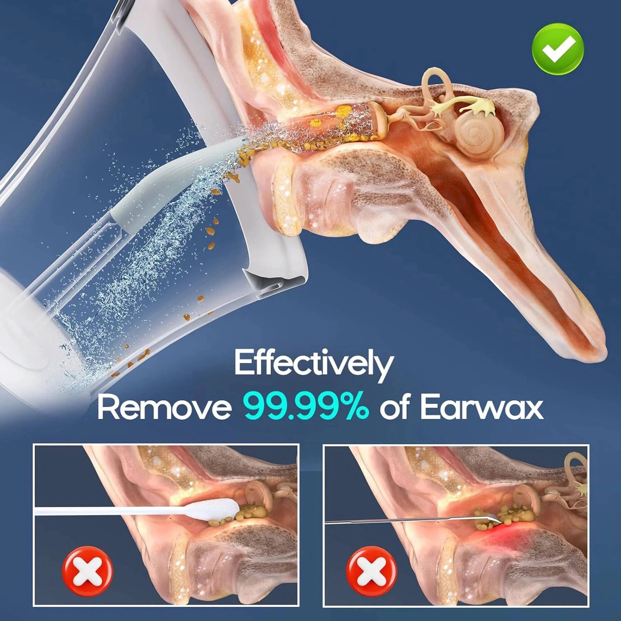 Ear Wax Removal with One-Piece Waste Tank, Ear Cleaner with Water Temperature Sensor, 4 Pressure Settings, Ear Cleaning Kit for Ear Wax Buildup & USB-C Cable, IPX6, White